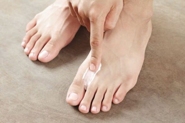 kenőcs alkalmazása a bőr gombájából a lábakon